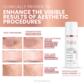 Lifting Cream - 0.1% Retinal