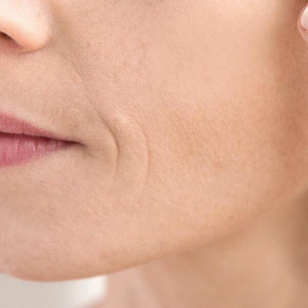 av_anti-age_visage_closeup_bouche_rides_1x1