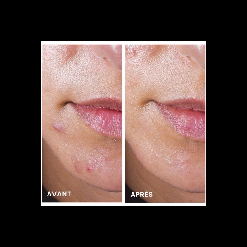 CLEANANCE COMEDOMED concentrado anti-imperfecciones