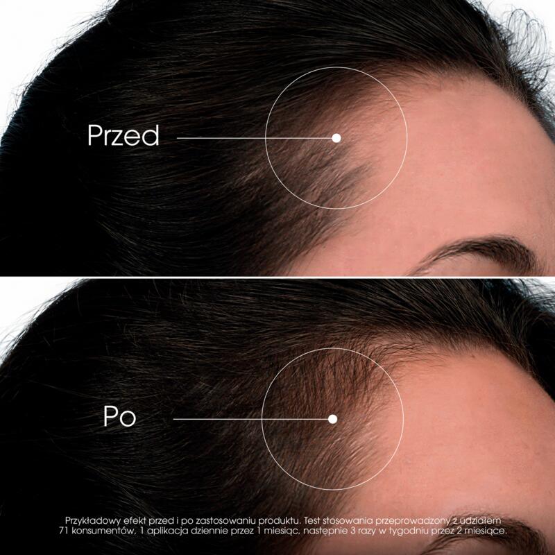 WZROST Serum intensywnie przyspieszające wzrost włosów z Adenozyną