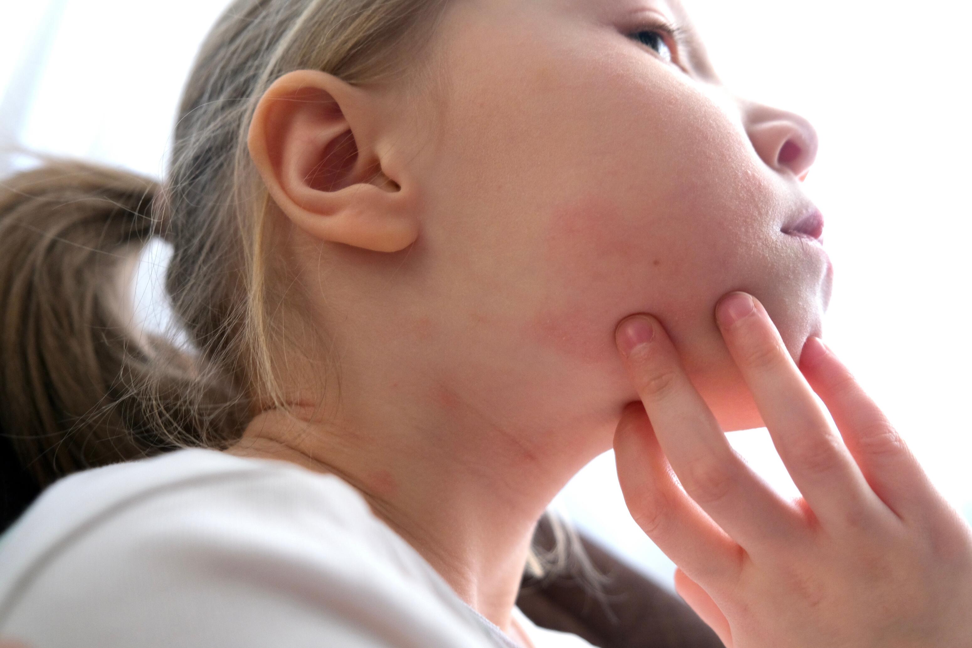 AD_WEBSITE_QUESTIONS-ENFANTS-ATOPIE_QUESTION1_2022