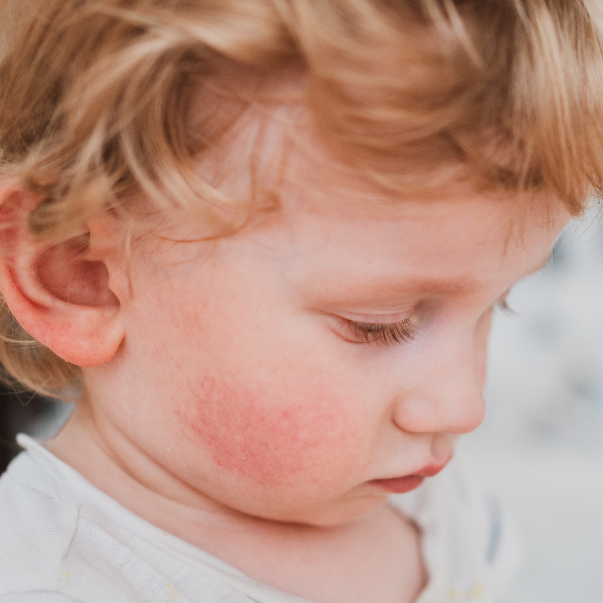 AD_WEBSITE_QUESTIONS-ENFANTS-ATOPIE_QUESTION4_2022