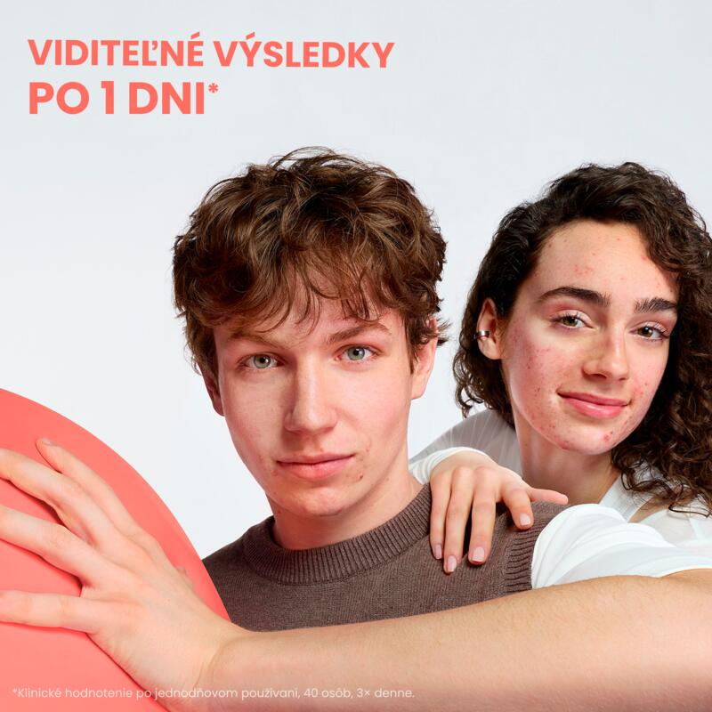 COMEDOMED PEELING Intenzívny krém pri zhoršených prejavoch akné
