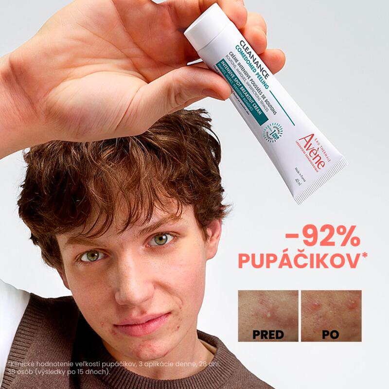 COMEDOMED PEELING Intenzívny krém pri zhoršených prejavoch akné