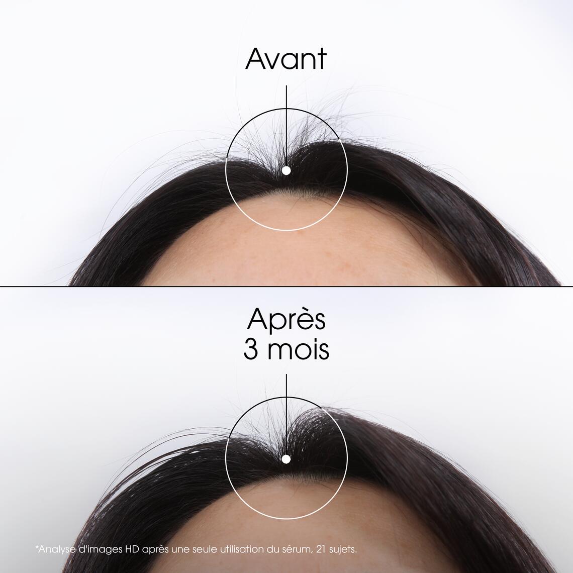 Résultats FORCE Sérum fortifiant intense