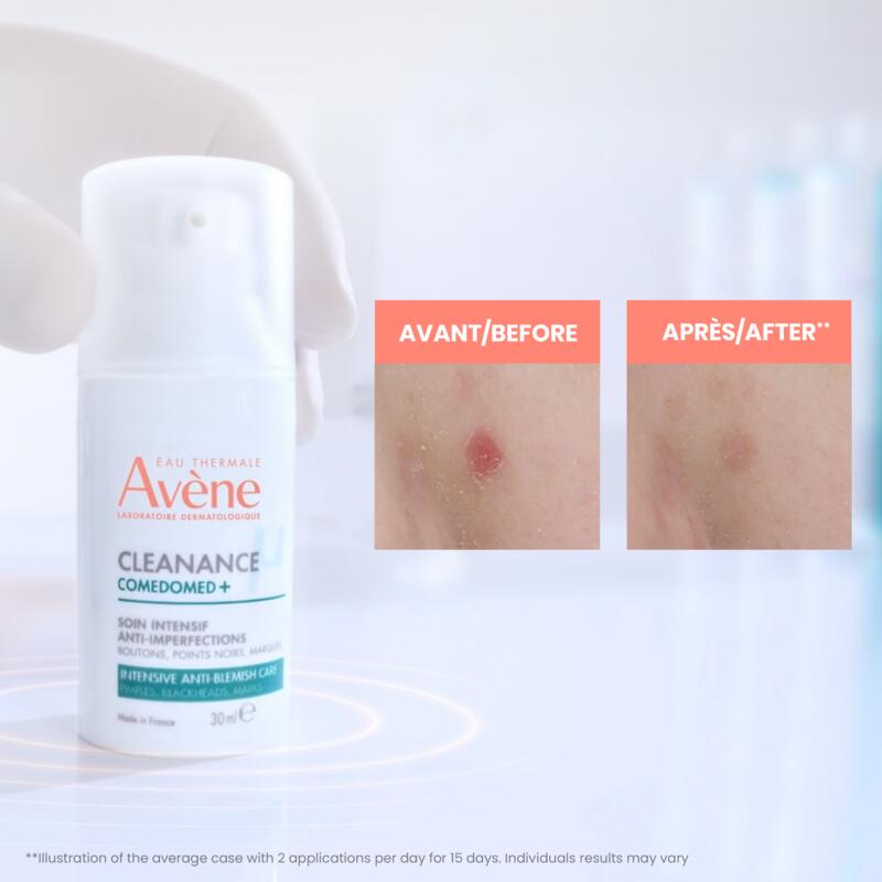 Cleanance Comedomed+ Anti-Blemish Care