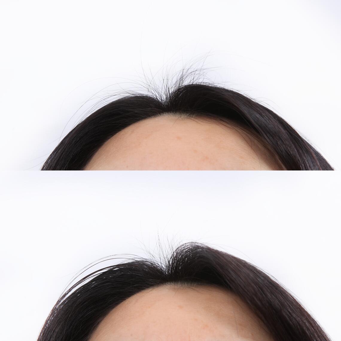 Αποτελέσματα Oρός εντατικής ενίσχυσης κατά της τριχόπτωσης με κινίνη.