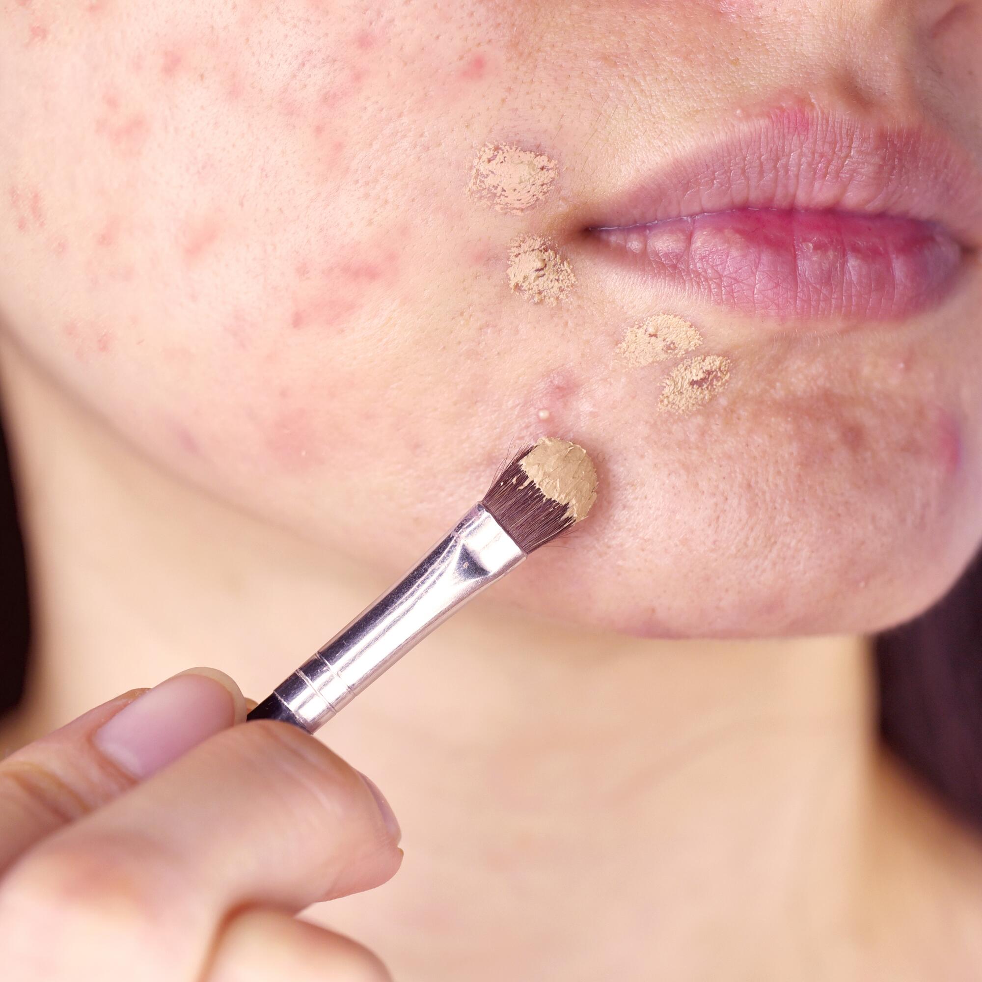 Brotes graves: el arte del camuflaje