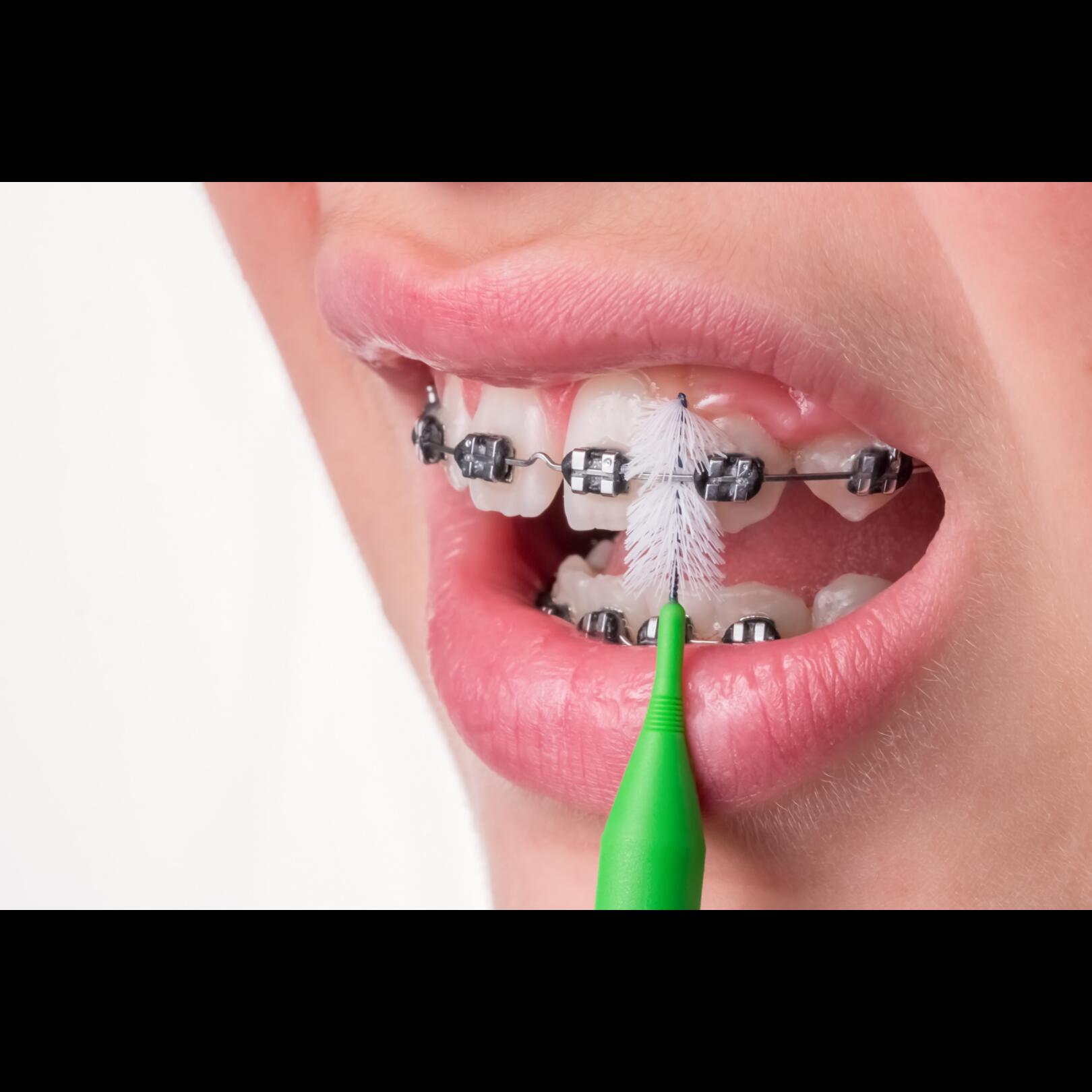 Inava MonoCompact verte (ISO 6) - brossette interdentaire