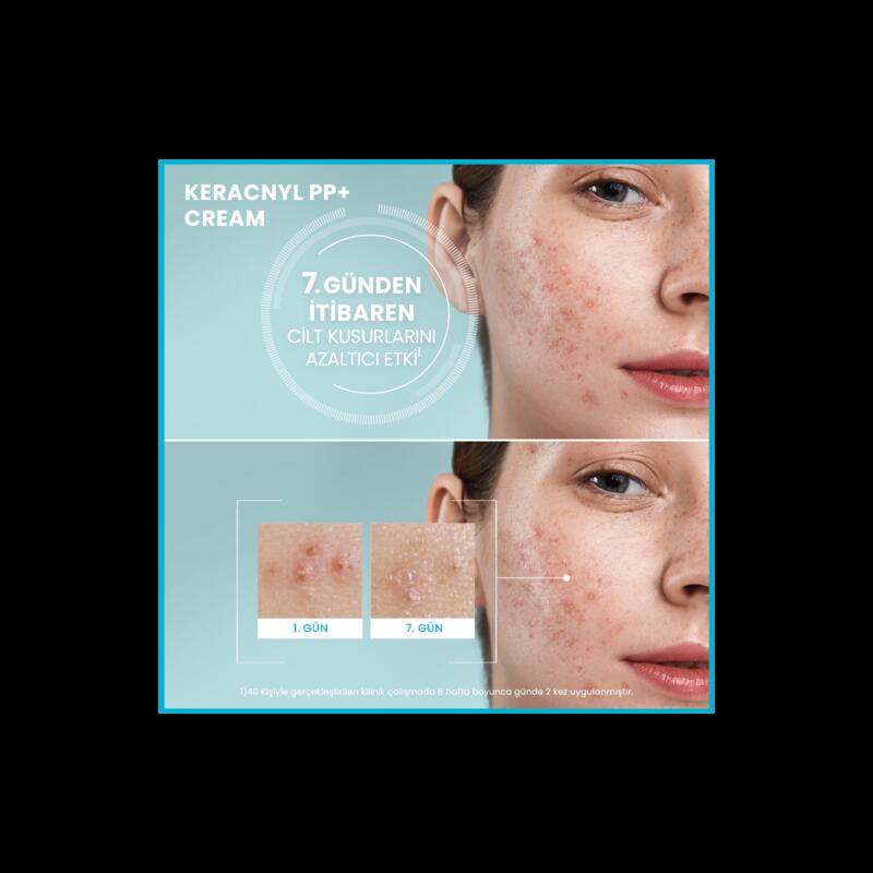 Yağlı ve Akneye Eğilimli Ciltler İçin Bakım Kremi