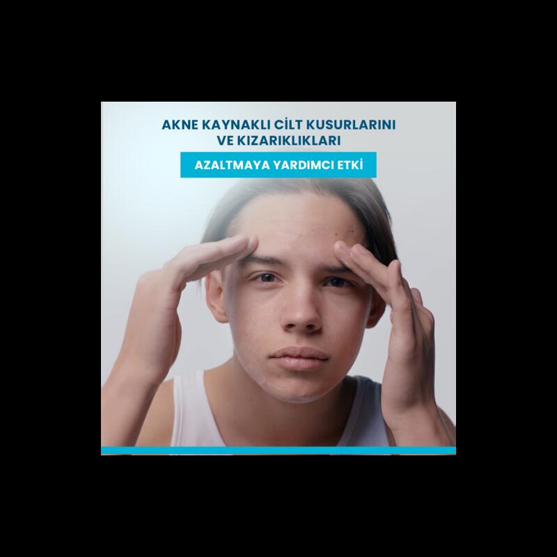 Yağlı ve Akneye Eğilimli Ciltler İçin Serum