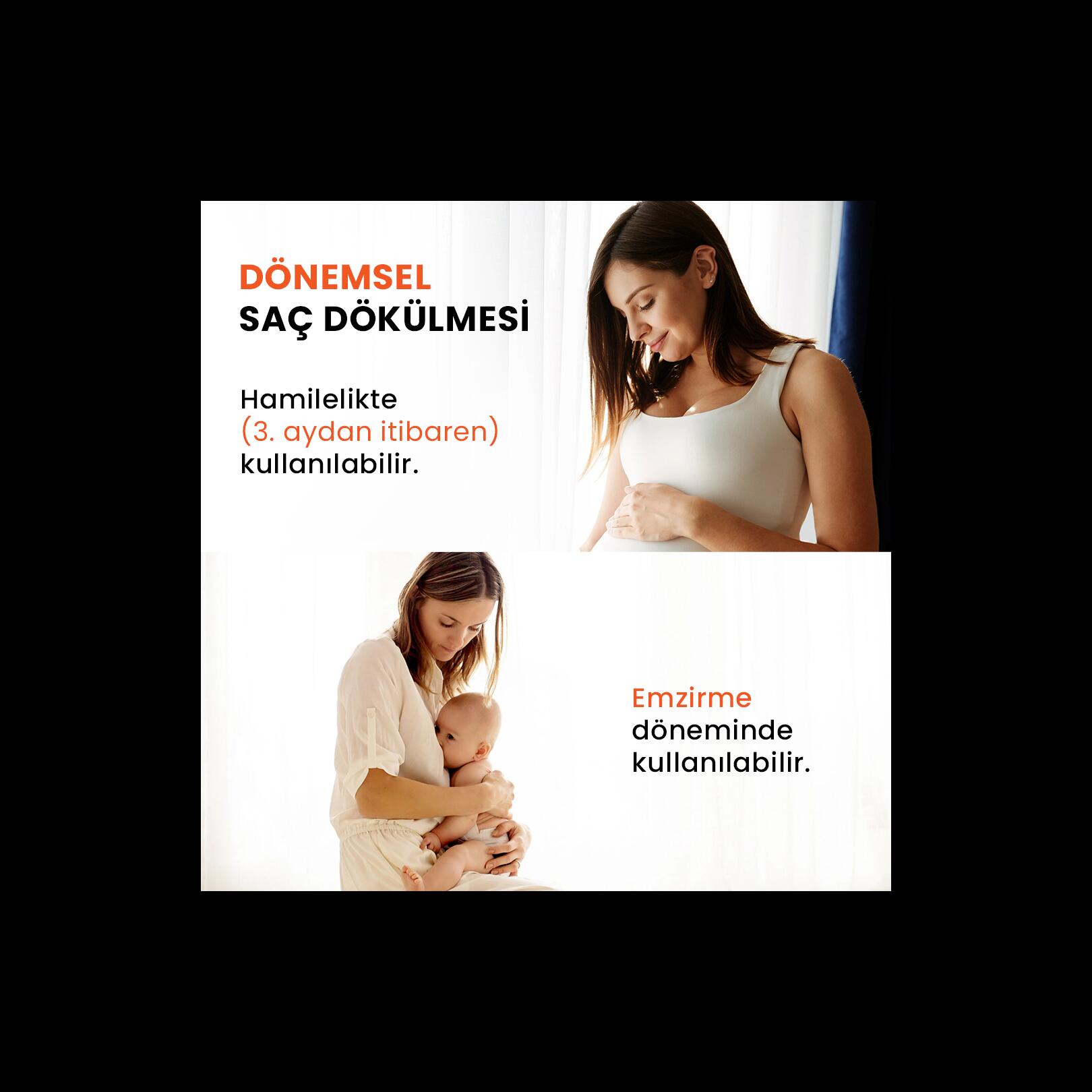 Saç Dökülmesi Karşıtı Losyon