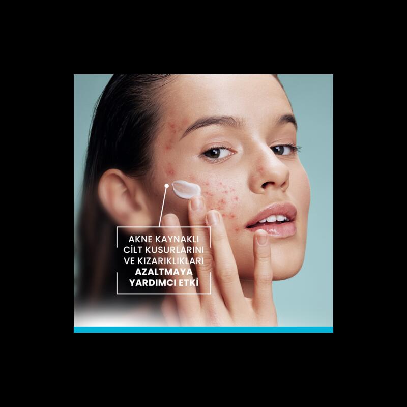 Yağlı ve Akneye Eğilimli Ciltler İçin Bakım Kremi