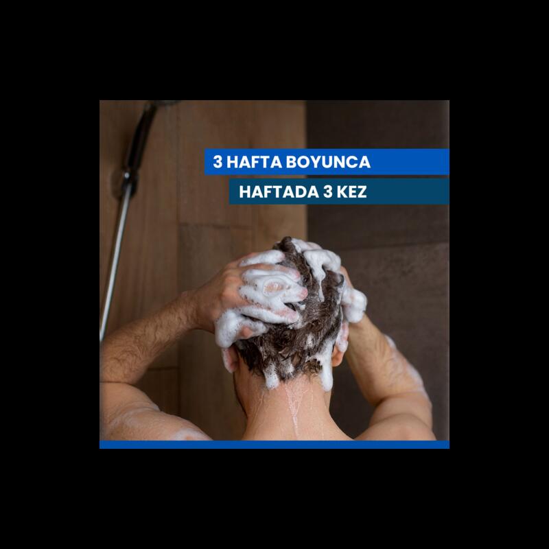 İnatçı ve Şiddetli Kepek Karşıtı Şampuan