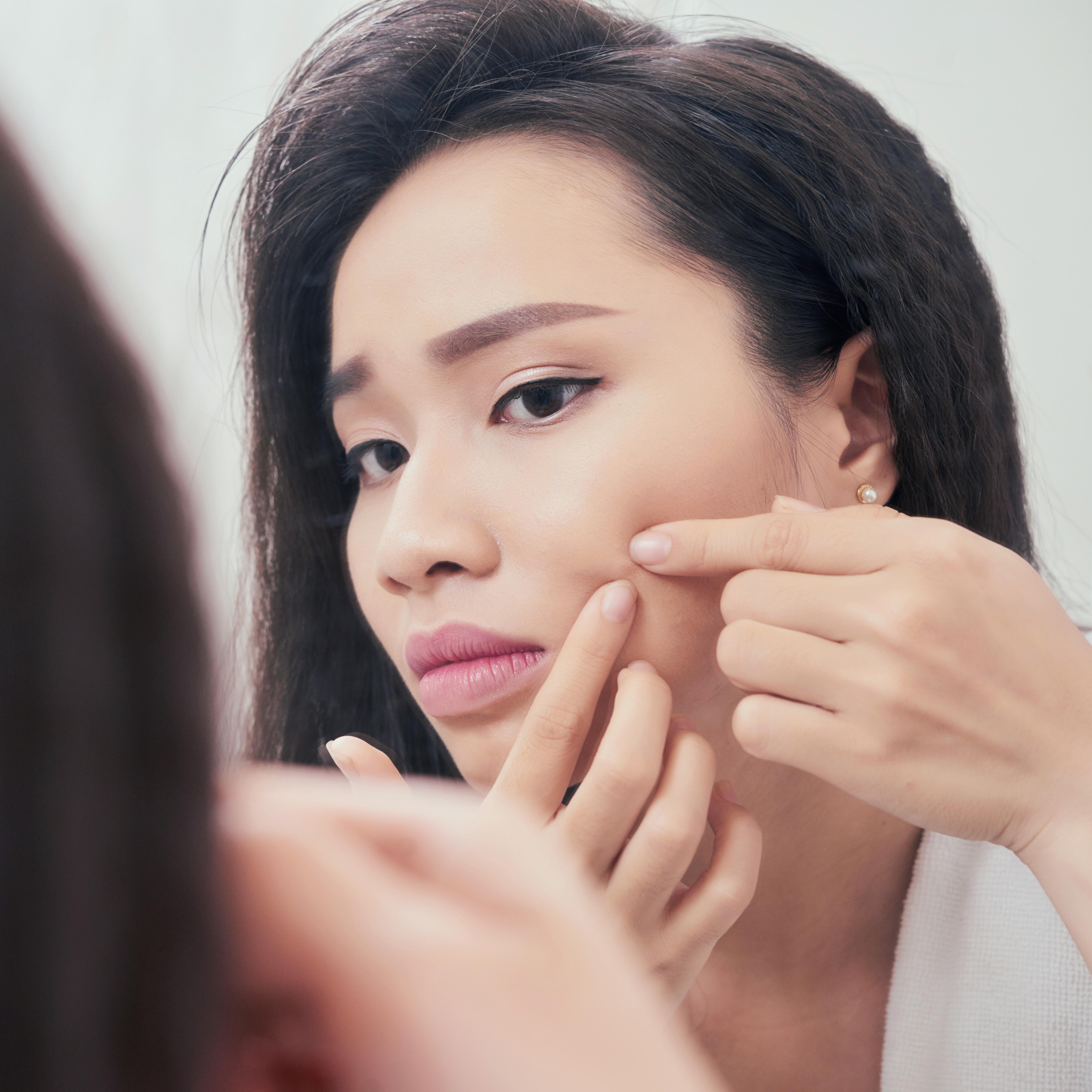 av_votre-peau_cicatrisation_acne_asiatique_jeune-femme_1x1