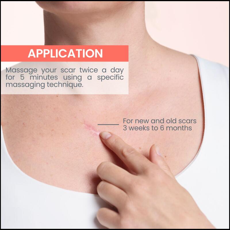 Cicalfate+ Remodeling scar gel