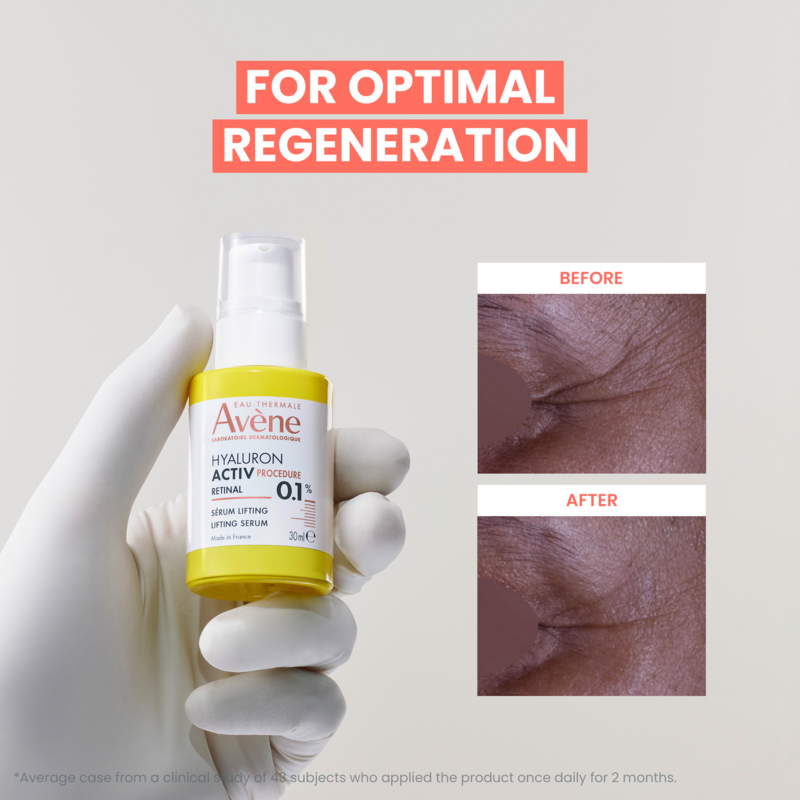 Lifting-Serum – 0,1 % Retinal