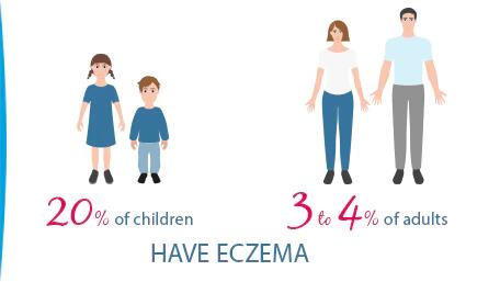 illustration-eczema-children-adults