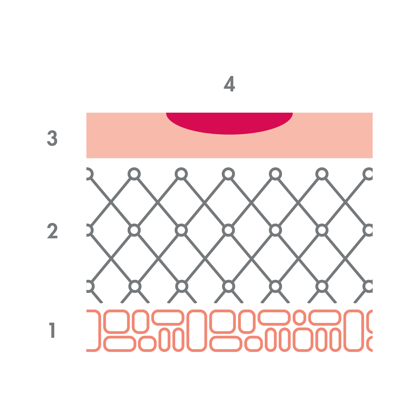 av_solaires_schema_brulure_degre-1_1x1