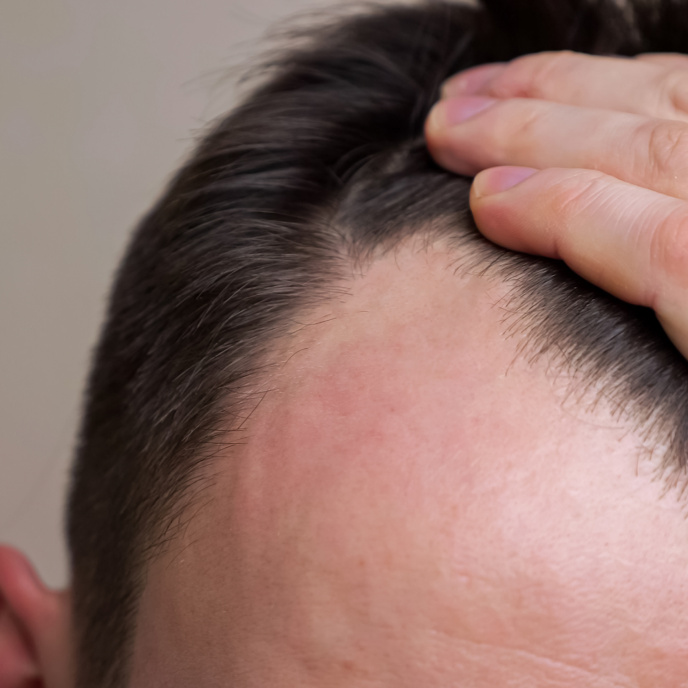 kl_quinine_haircare_semantic-cocoon_hairloss_men-1_1-1