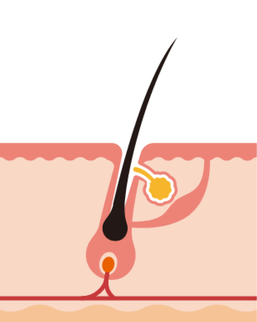 <p>La phase de transition (dite catag&egrave;ne) repr&eacute;sente le moment o&ugrave; le cheveu arr&ecirc;te de pousser, elle dure environ 2 &agrave; 3 semaines.</p>

