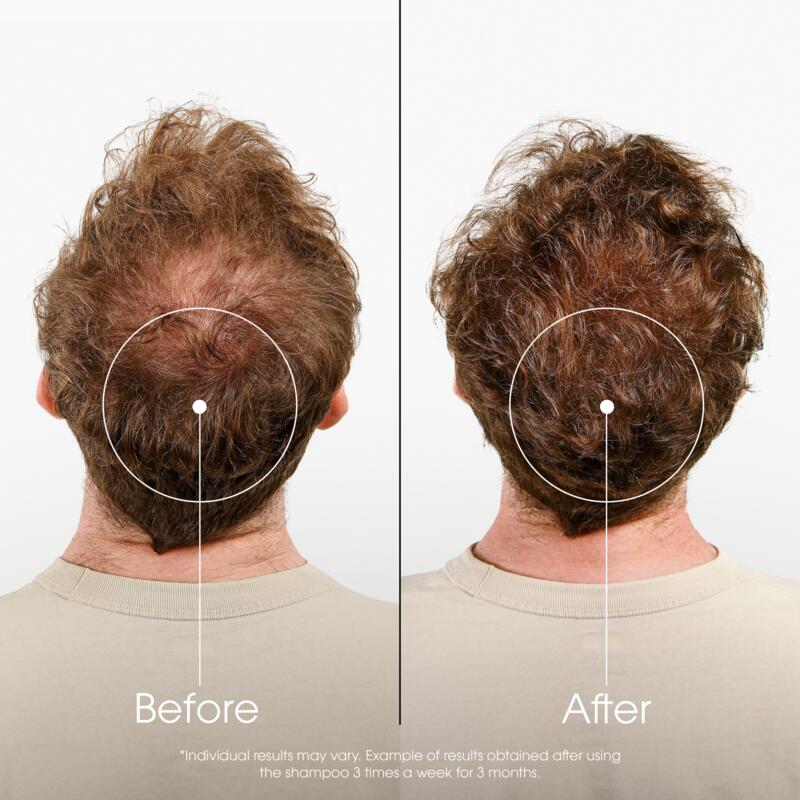 ANTI-HAIR LOSS strengthening and stimulating Shampoo with Quinine