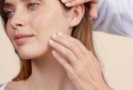 Vette huid met onzuiverheden en acne