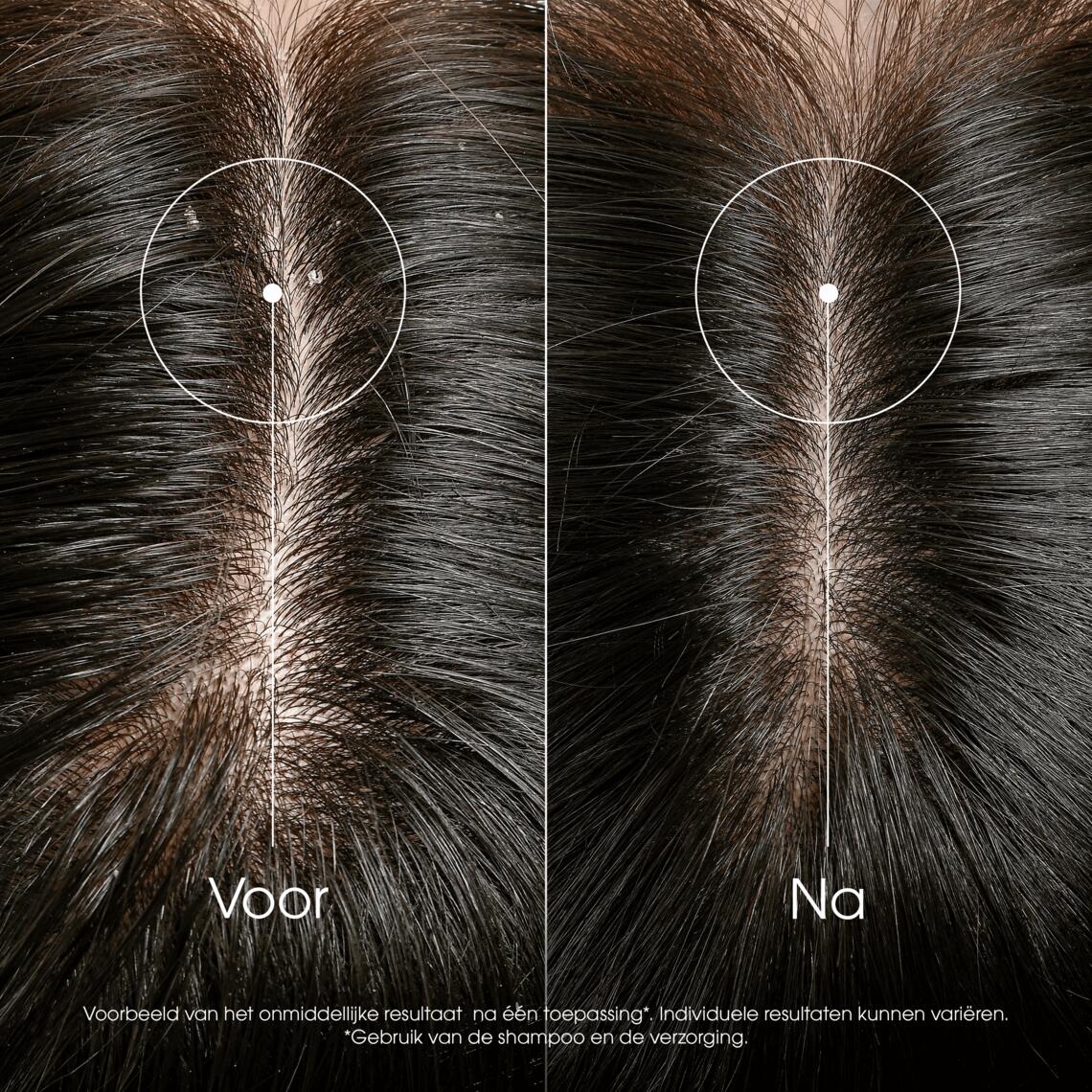 Resultaten ANTI-ROOS Verzorging tegen jeuk 