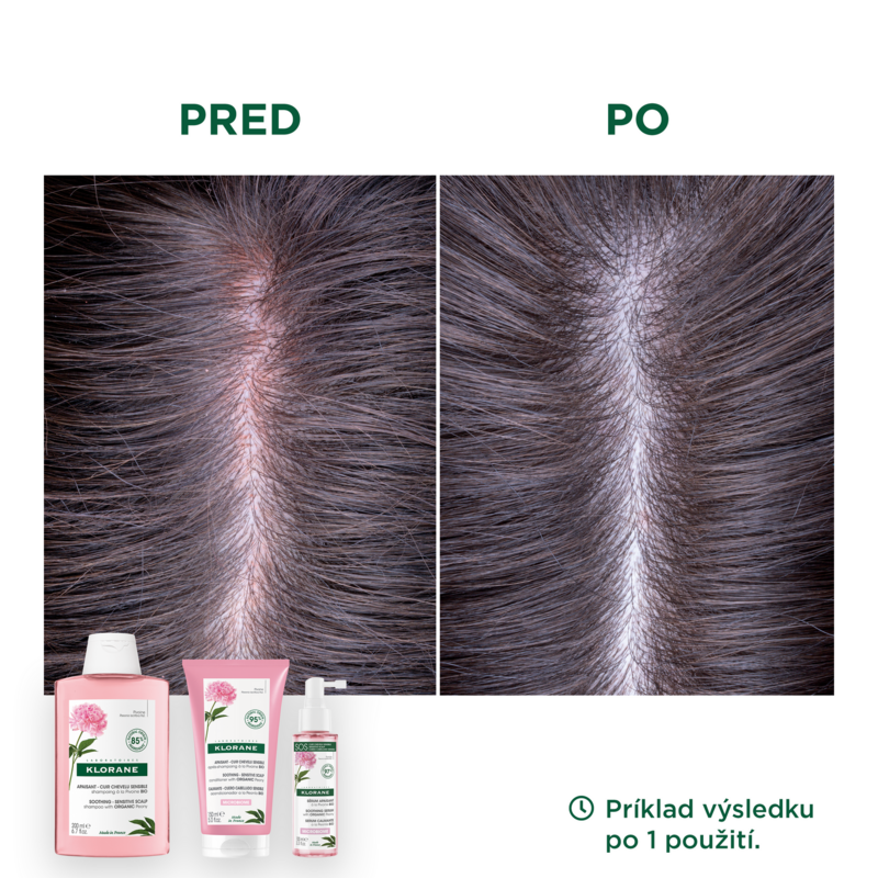 Upokojujúce sérum s BIO pivóniou – upokojenie citlivej a podráždenej vlasovej pokožky