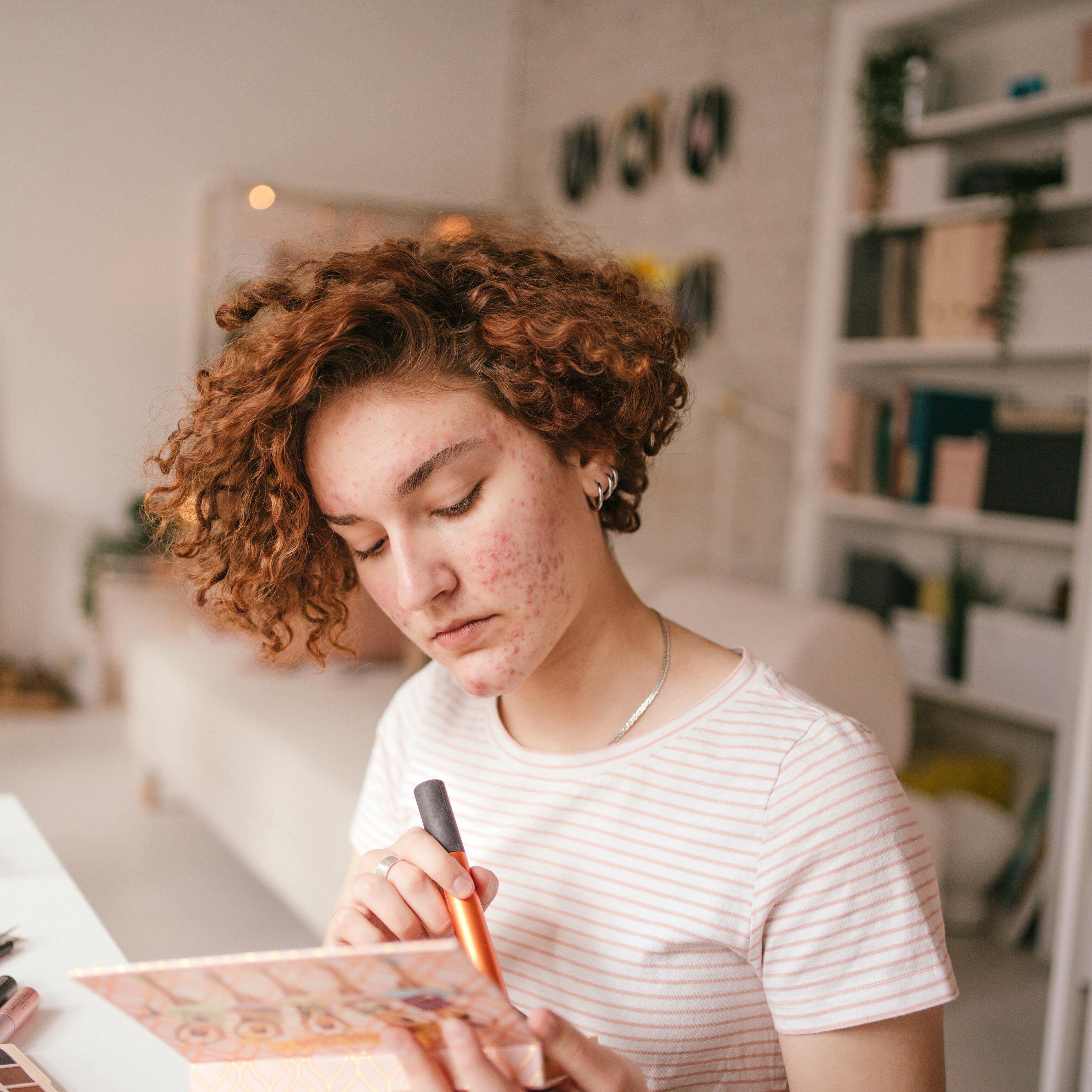 av_maquillage_adolescente_acne_1x1
