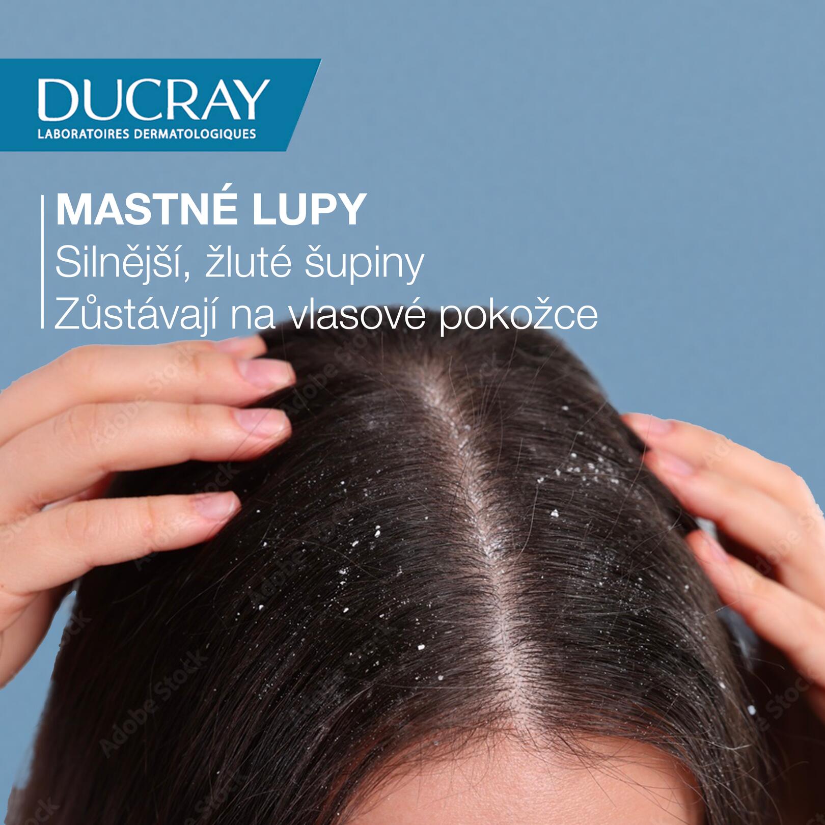 KELUAL SQUANORM Seboregulační pečující šampon proti mastným lupům