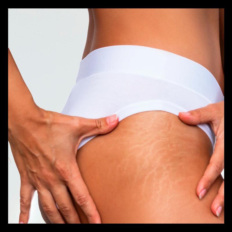 Gel-huile de massage anti-marques