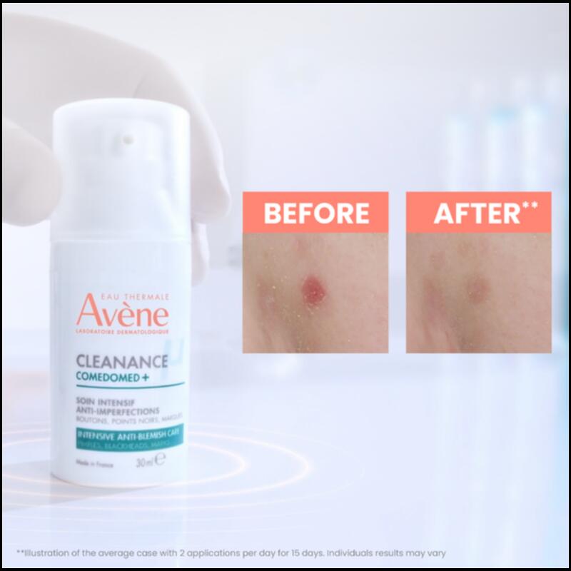 Comedomed+ Intensive Anti-Blemish Care
