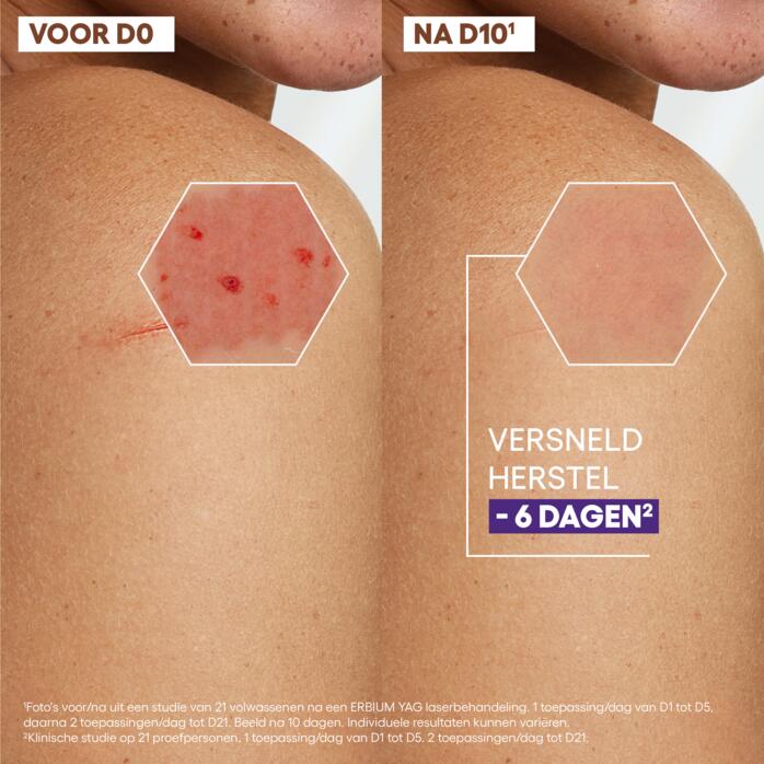 Resultaten Herstellende Crème tegen vlekken