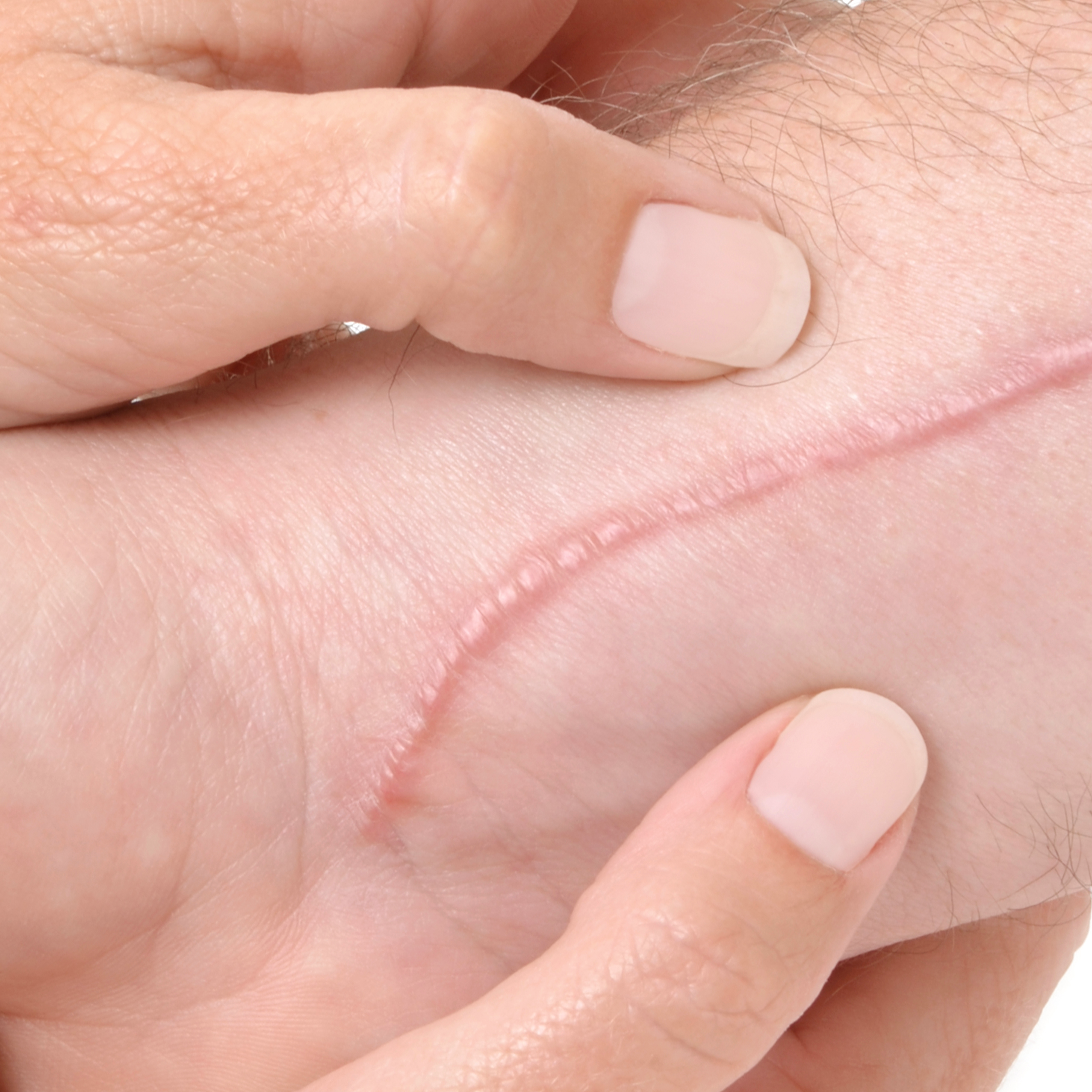 av_votre-peau_cicatrisation_massage_1x1 473x473