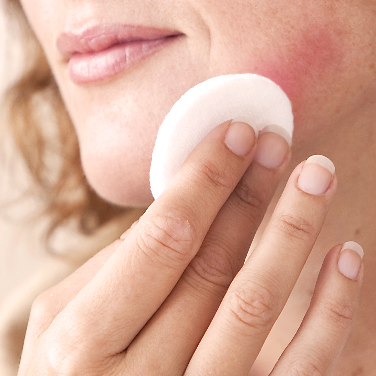 av_votre-peau_cicatrisation_irritations_solager_conseils_1x1 1:1