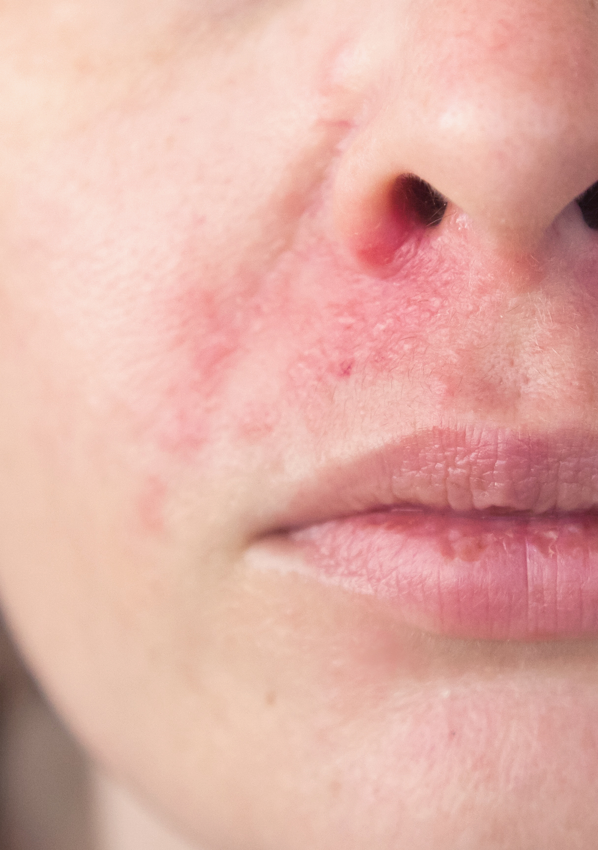 av_votre-peau_cicatrisation_irritations_allergies_visage_4x5_2 473x473