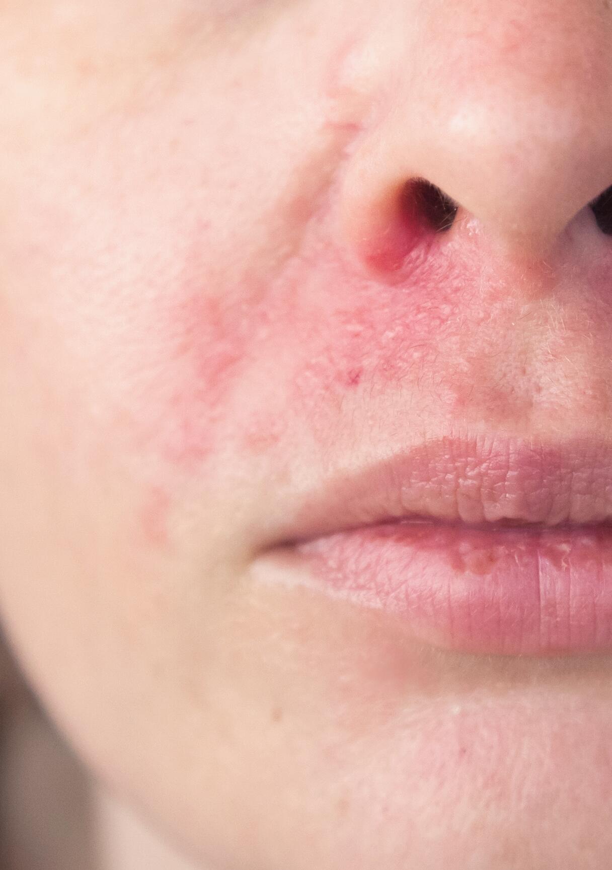 av_votre-peau_cicatrisation_irritations_allergies_visage_4x5_2