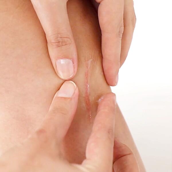 av_votre-peau_cicatrisation_palper-rouler_1x1