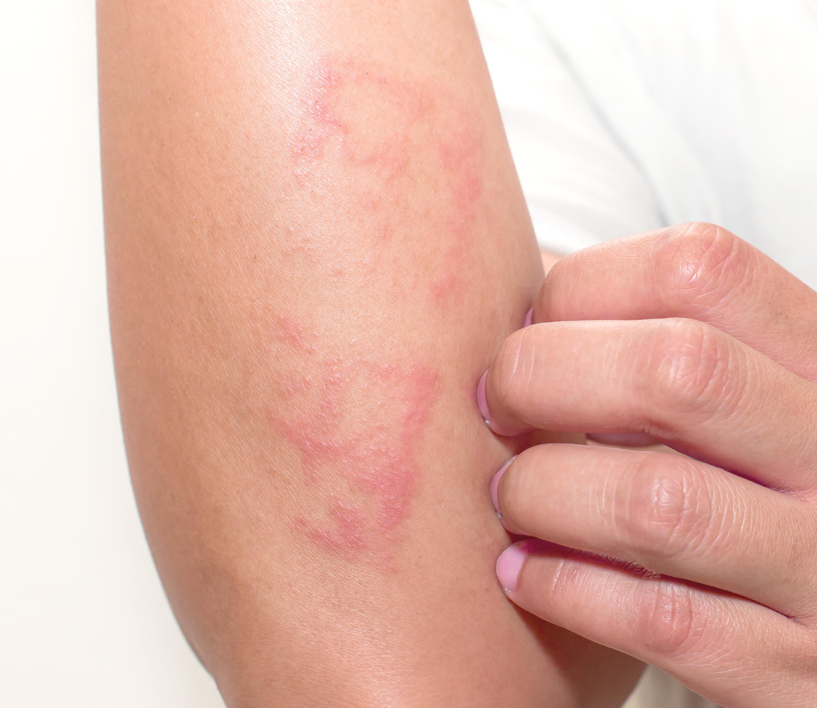 Your skin feels irritated. Okay, but what’s the cause?