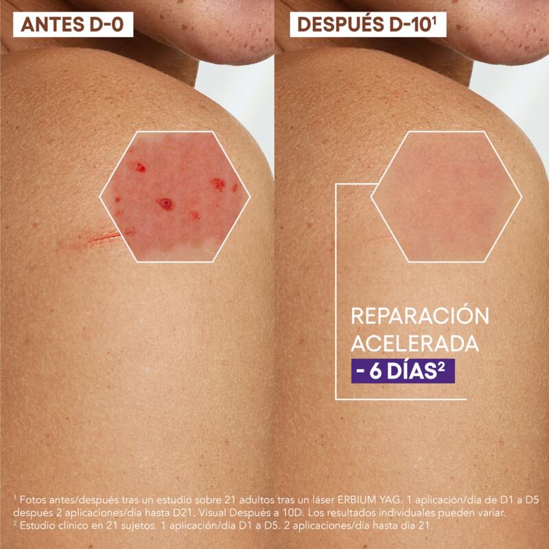 Crema Reparadora Anti-marcas 						