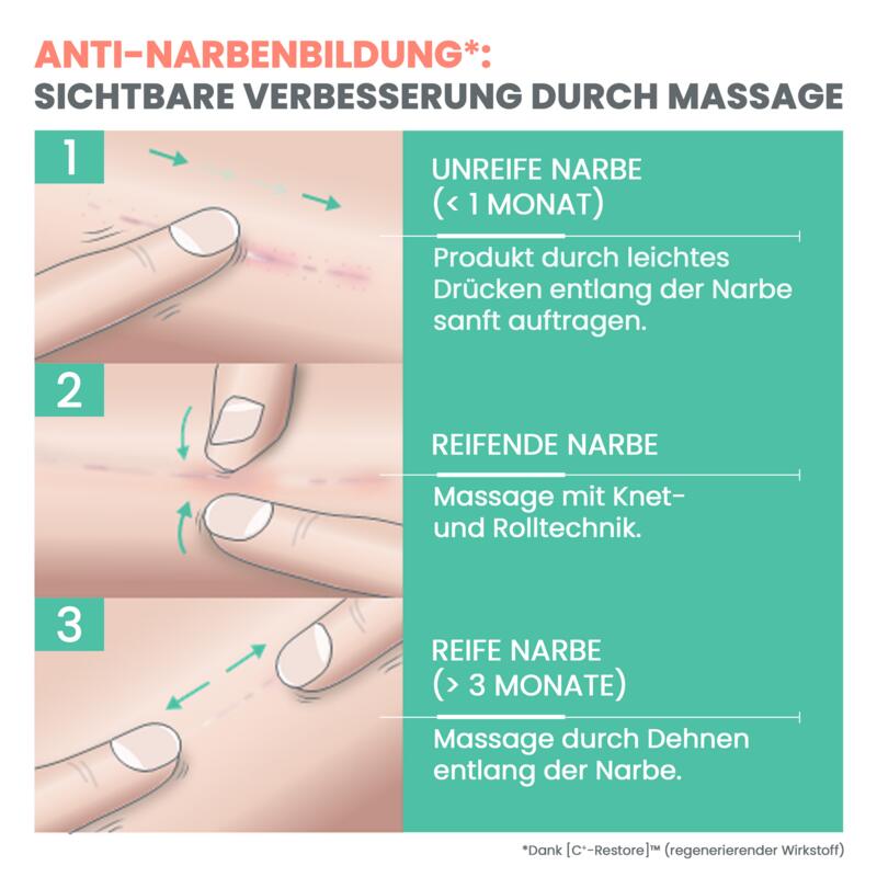 Narbenpflege-Gel