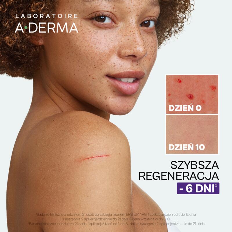 Krem regenerujący przeciw śladom