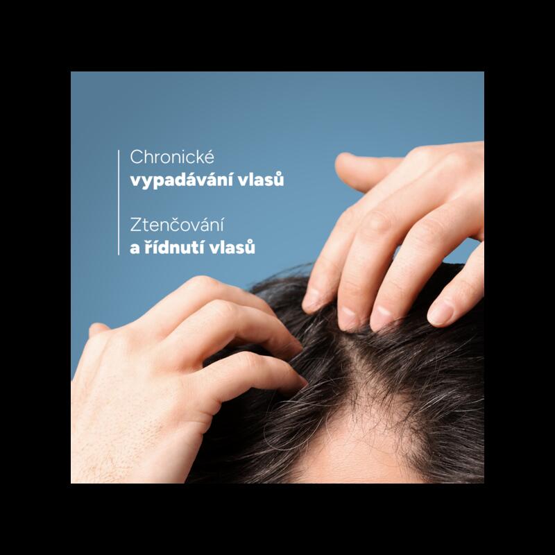 Šampon proti chronickému vypadávání vlasů
