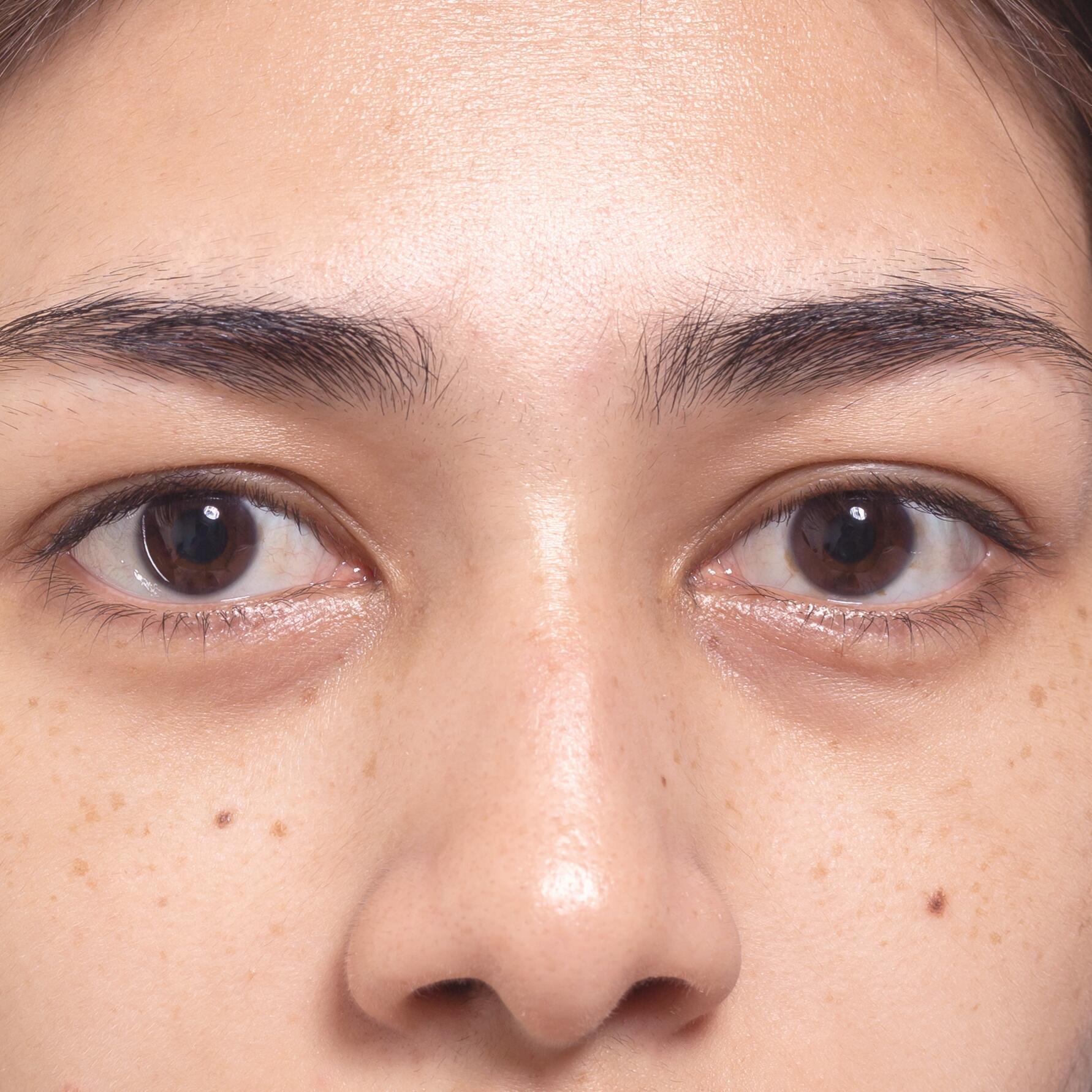 av_carnets-experts_peau-mixte_zone-t-brillante_1x1