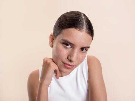 Akneler hakkında bilmeniz gereken her şey