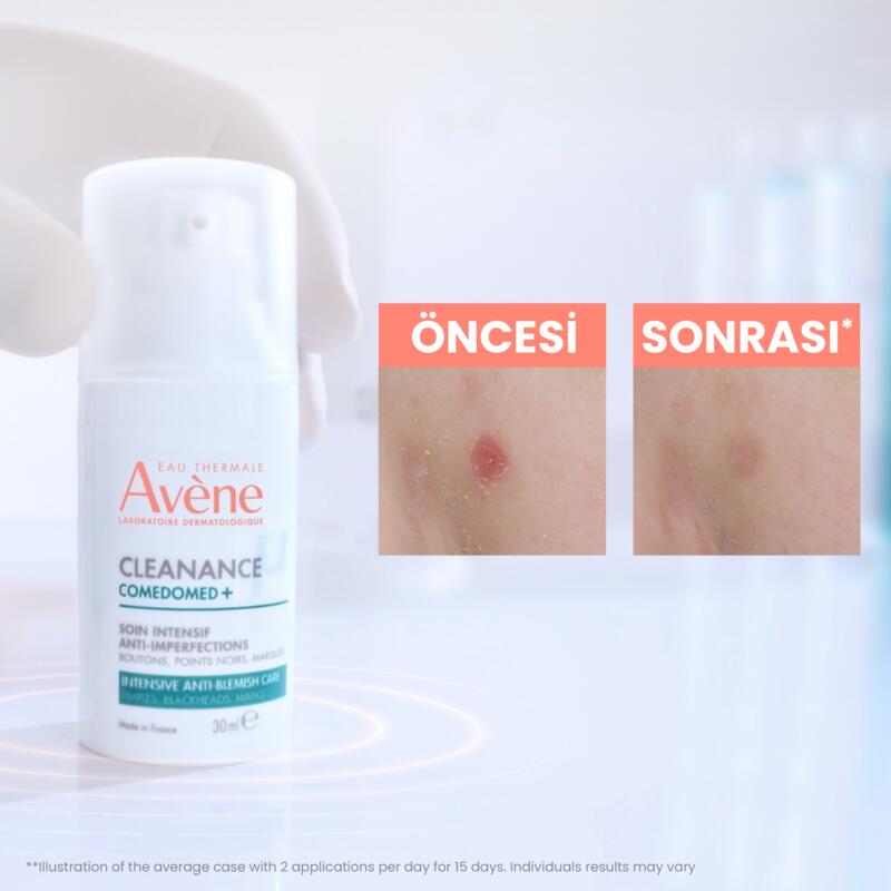 Cleanance Comedomed+ Niasinamid İçeren Cilt Kusurları için Yoğun Bakım Kremi 30 ml