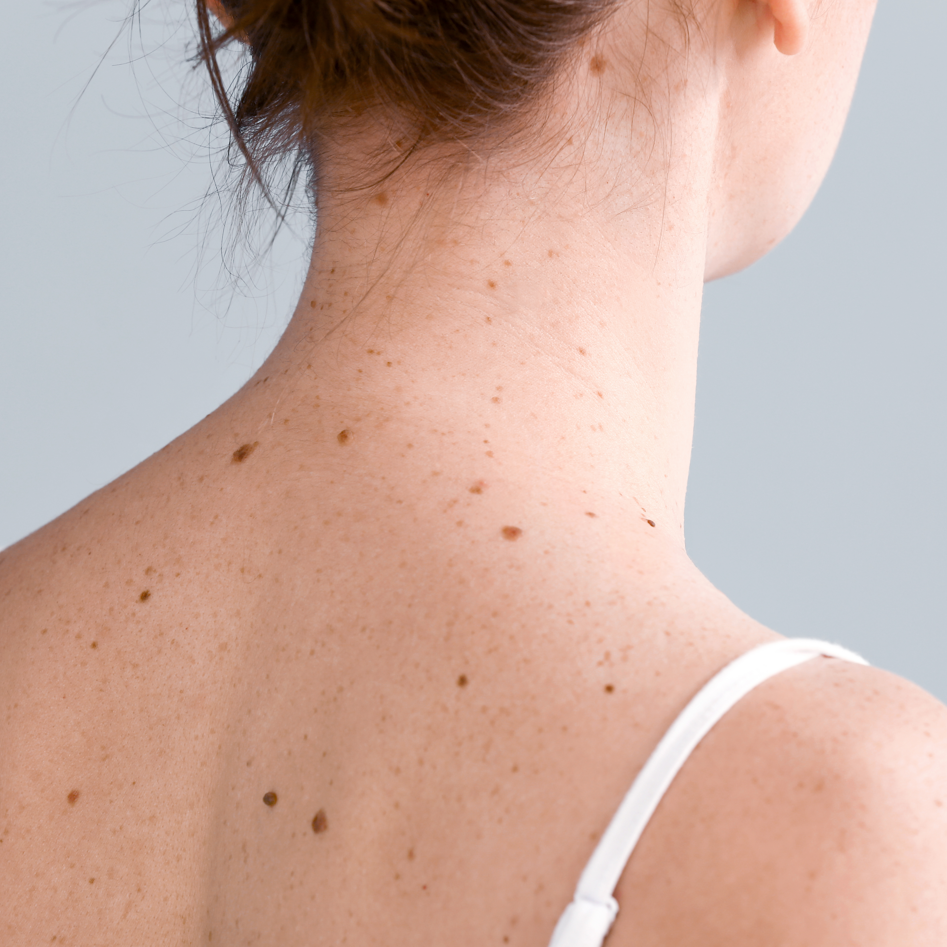 av_solaires_proteger_grains-de-beaute_1x1 473x473