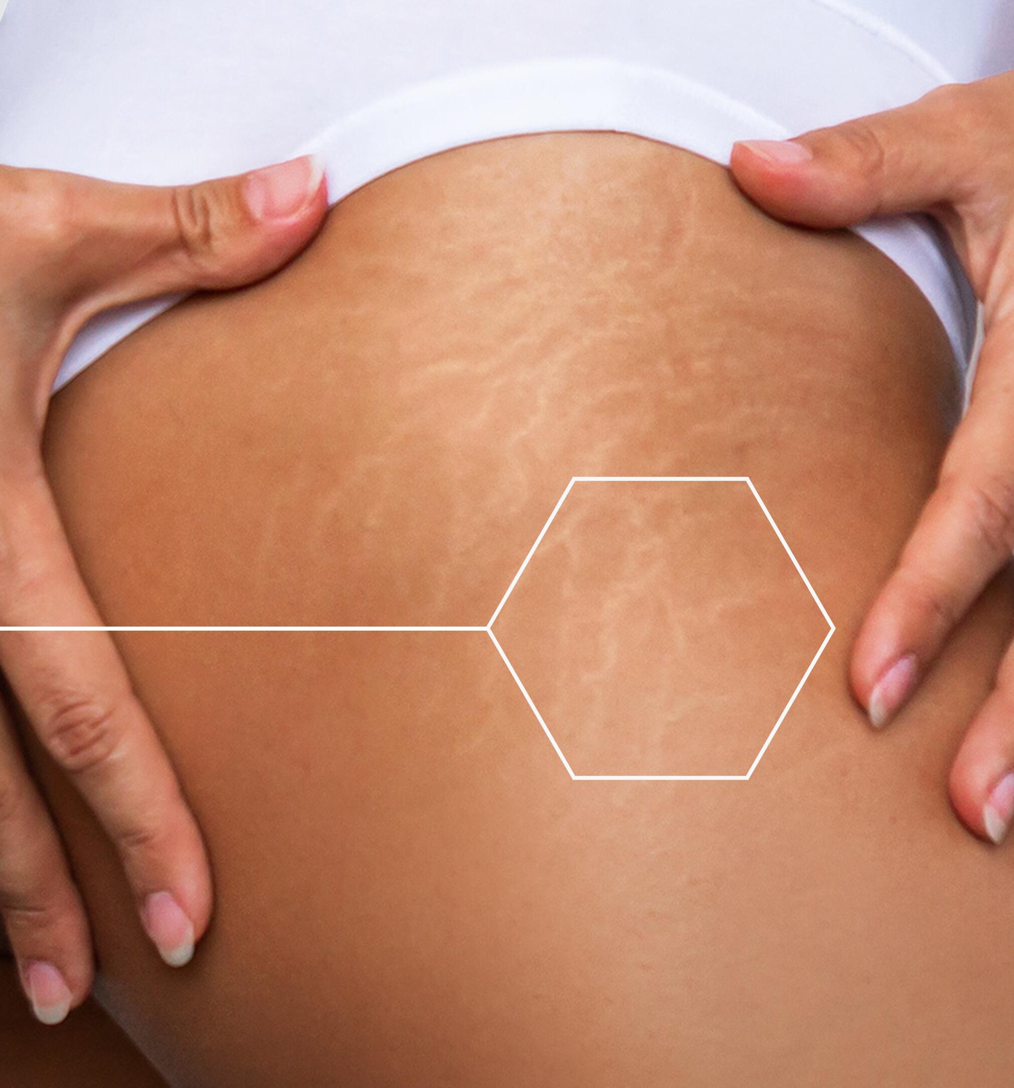 AD_EPITHELIALE_ULTRA-REPAIR_MASSAGE-GEL-OIL_HA-_BENEFITS_11-2024