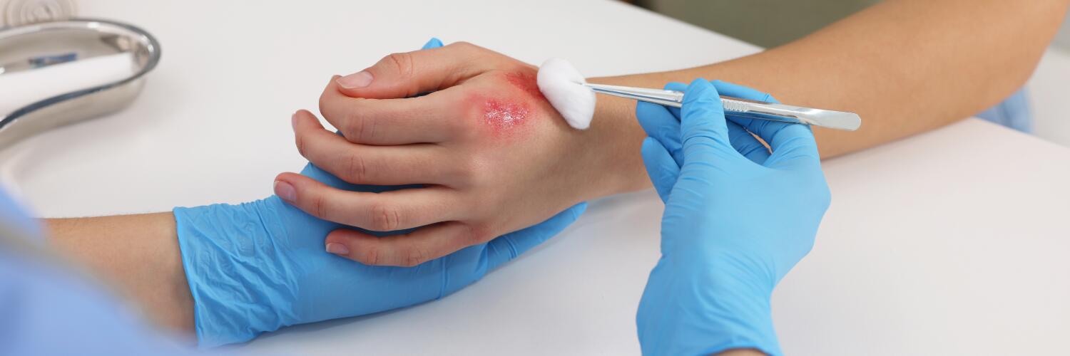 AD_EPITHELIALE_WOUND-DISINFECT_SILO_L1_GUIDE_HEADER